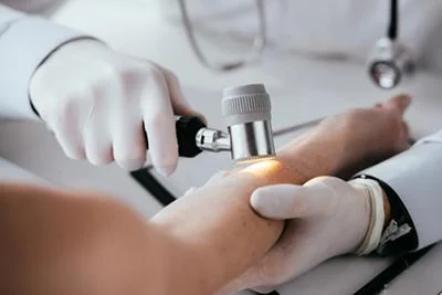 Wart removal procedure in Ithaca NY
